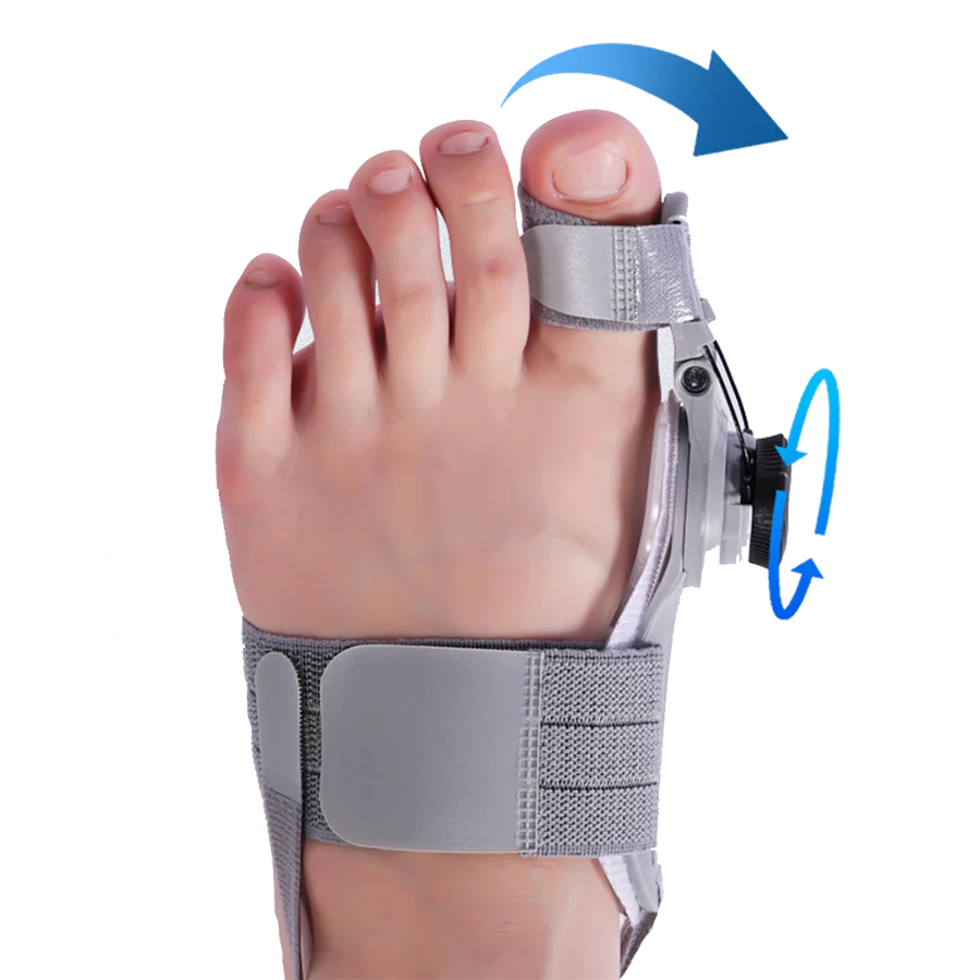 AlluceFix™ correttore per bunioni